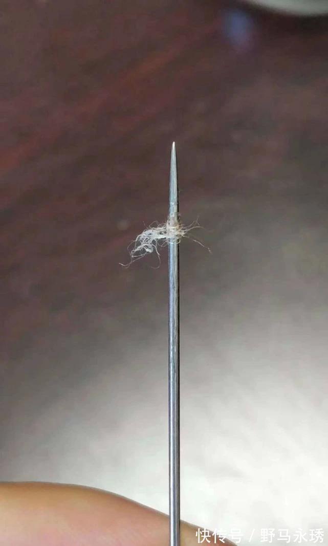 棉花丝|有痔疮的人，后腰常有“红色小点”，里面藏着“棉花丝”