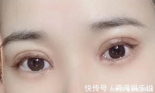 行政部门|姑娘花10000多割双眼皮,曝出前后对比照,网友直言勇气可嘉!