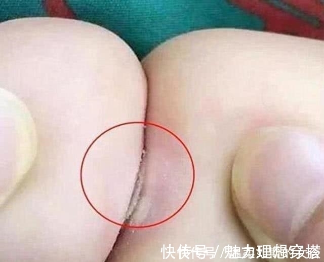 奶奶们|奶奶炫耀把孙子养的白胖,路人看后无奈:赶紧去医院看看吧