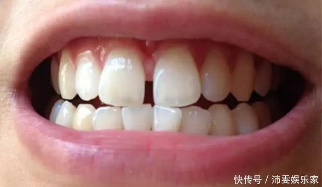 皱纹|女性开始衰老,有3处变长,1处变圆,若一个不占,说明还年轻