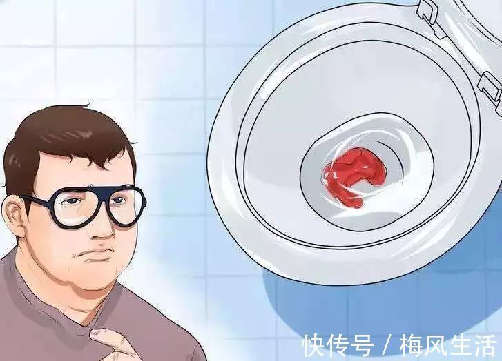 福尔马林|26岁女孩,腹泻不止,肠癌离世,医生惋惜:1个习惯害的她