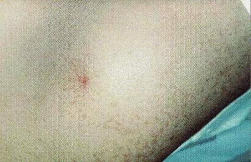 保护肝脏|肝好不好，看四处，“远离三物，做好三字”，肝会越来越好！