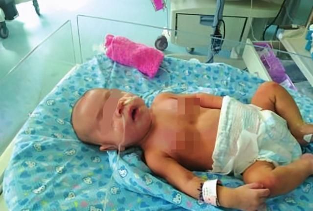 食物过敏|五个月女婴双肾长满结石,只因刚出生三天,父母就开始做这件事