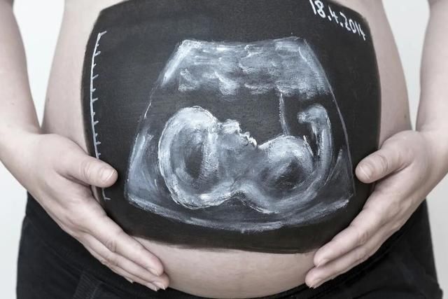 孕妈|胎儿头大、腿短，产检时医生给的性别“暗示”，家长可要放在心上