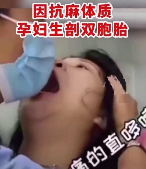 分娩|抗麻体质孕妇“生剖”双胞胎,哭声撕心裂肺,产房外丈夫泪如雨下