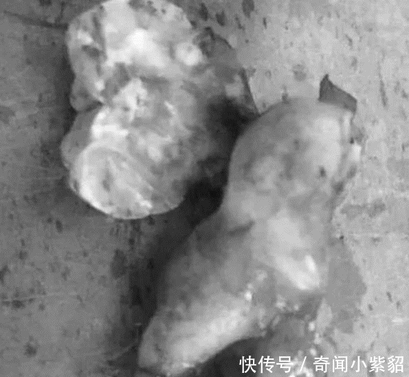 小伙|小伙经常熬夜,脸颊突发的就肿了起来,到了医院检查完让人不淡定