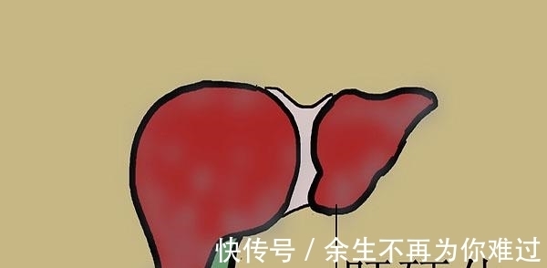 现象|肝硬化来袭之前,身体或会释放一些求助信号,可惜很多人视而不见