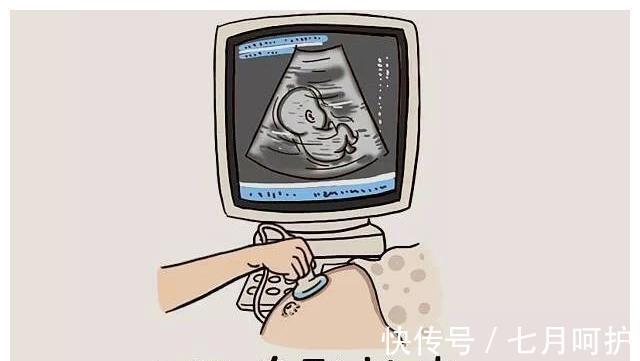 医生|孕妈做四维为什么不能让家属陪同?做完检查之后才知道医生的良苦