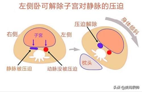 孕期侧睡有半边肚子压着的要紧吗？