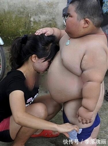 医生|3岁小男孩胖达120斤,智力超乎常人,医生的话让母亲难以接受