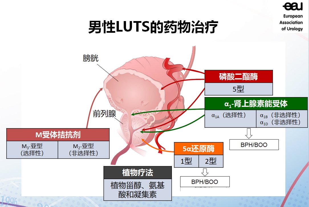 排尿期|什么是良性前列腺增生症（BPH）？如何确定和治疗？