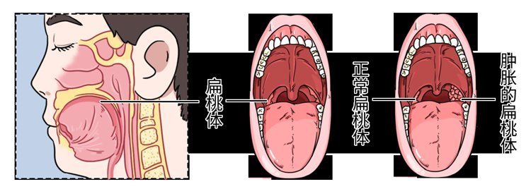 科学证实长期用嘴巴呼吸的人，样貌会越变越丑一对比不忍直视