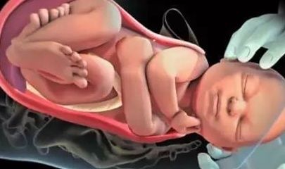 骨产道|自然分娩过程中，胎儿也在默默帮着妈妈，真的太暖心了！