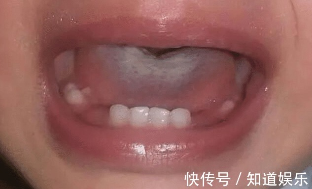 妇幼医生|初三少年一年长高19厘米,妇幼医生:这习惯很好,建议父母多学