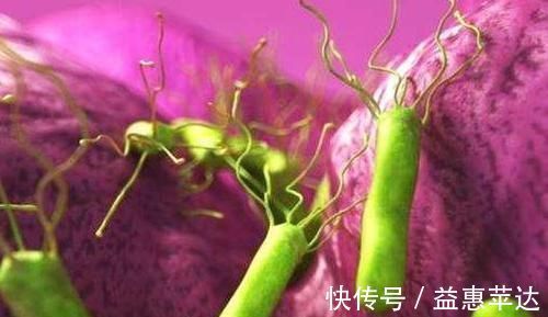 炎症|幽门螺杆菌呈阳性，坚持三件事，炎症可能会慢慢消除，胃也健康了