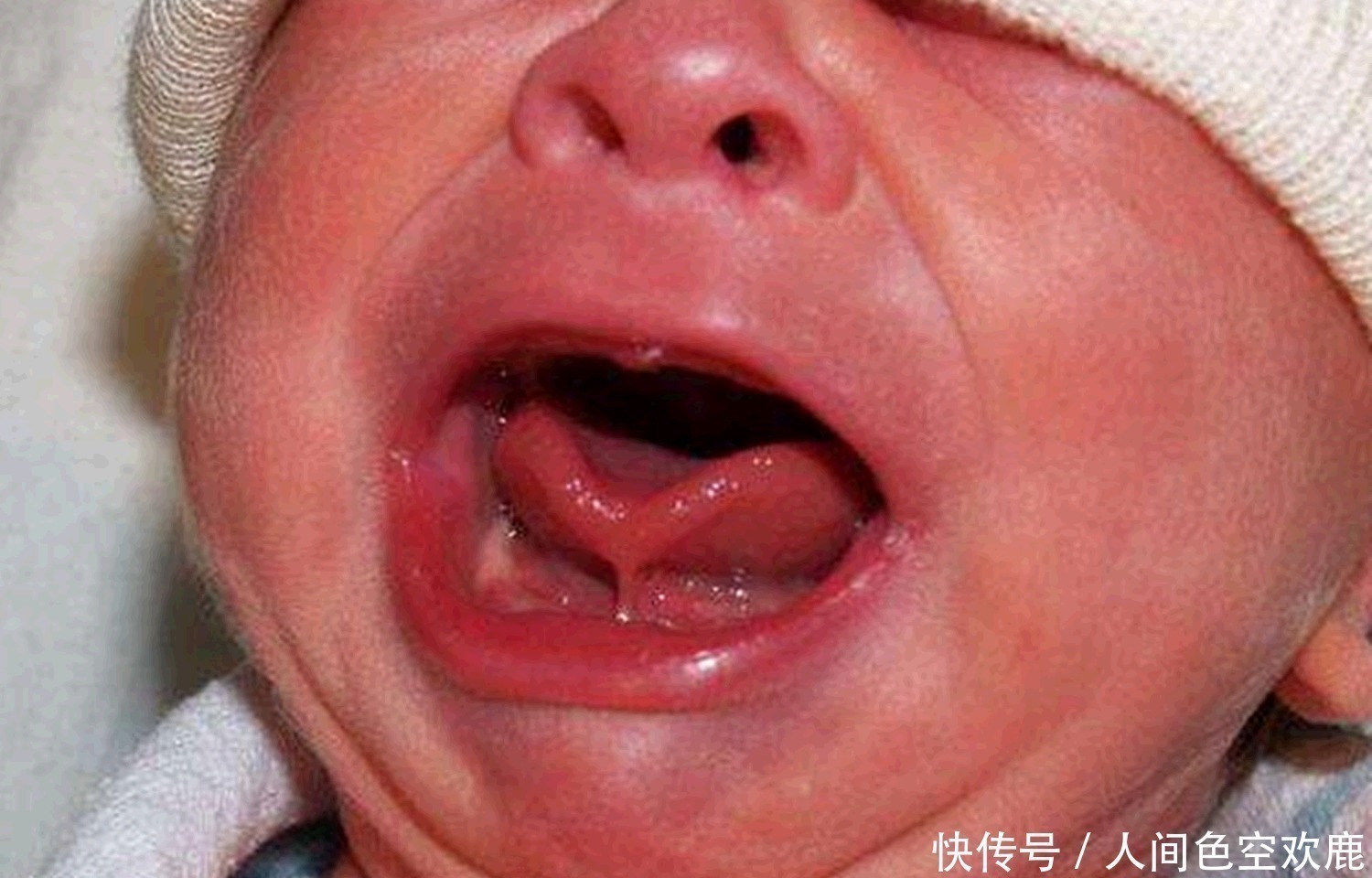 医生|1岁宝宝还不会说话,奶奶出生时没剪“舌根”,被医生揭穿