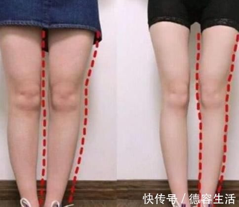 运动过度|明明不胖为何“腿”却那么粗原来是3习惯在作怪，女生长点心吧
