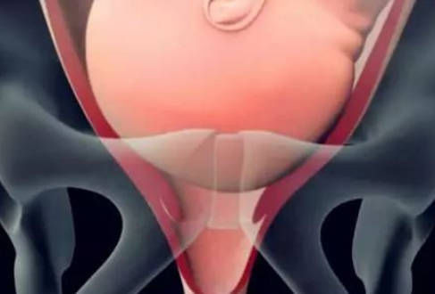 小子宫|产房分娩的过程是啥?实拍图还原顺产过程,看完明白为母则刚