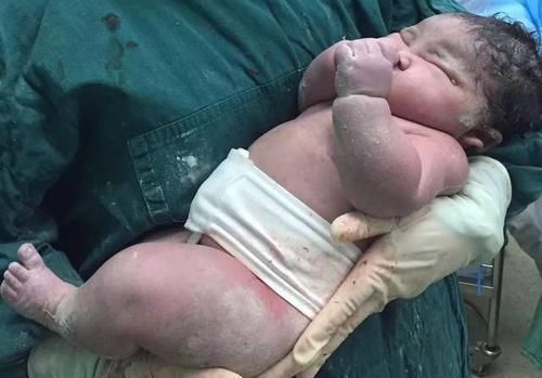 医生|顺产还是剖腹产?医生:想顺产,必须满足5点,缺一点都不少受罪