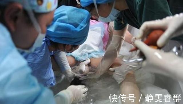 临床研究|为啥越来越多孕妇选“水中分娩”看过这些优势,谁不想选