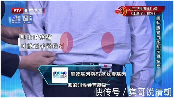 结石|致命肾癌竟是结石惹的祸2大饮食习惯暗藏风险,可惜很多人不知