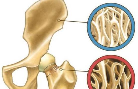 氨基葡萄糖|中老年人能长期吃“氨糖软骨素”钙片吗？医生：；留意2点很重要
