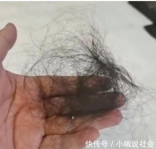 非常6+1|51岁李菁菁回顾抗癌经历,花式鼓励病友,与30岁三婚老公秀恩爱