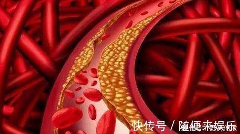 蒸米饭|天然“胰岛素”终于找到了,蒸米饭时加一点,血糖会慢慢降下来