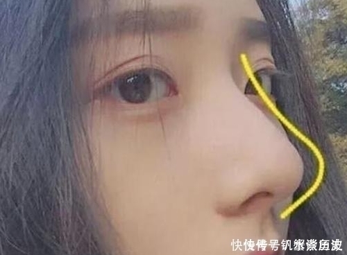 黑头 鼻子上挤出“白色条状物”？护肤达人：学会这3招，“草莓鼻”再也与你无缘