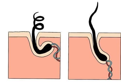 男性|胡子长得快的男性，大多都有2个“共性”，若你也是，偷着乐吧