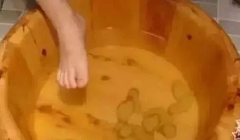 生姜|2片姜,1勺糖,老祖宗传下来的东西,竟能治这么多病!