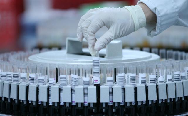 体检|体检报告3个指标正常,也没有6个症状,恭喜你的肝脏很健康