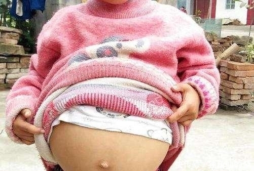 西瓜|12岁少女肚子“大如西瓜”家人以为怀孕,医生一席话令家人崩溃!