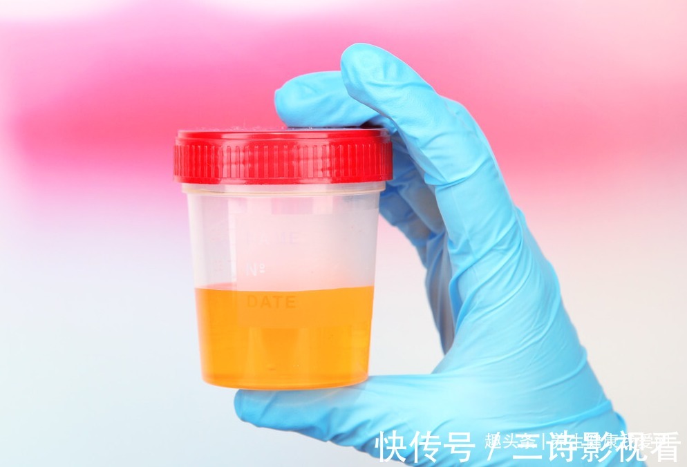 排尿|一喝水就尿，喝水后很久才尿，哪种情况才是肾脏出现了问题？