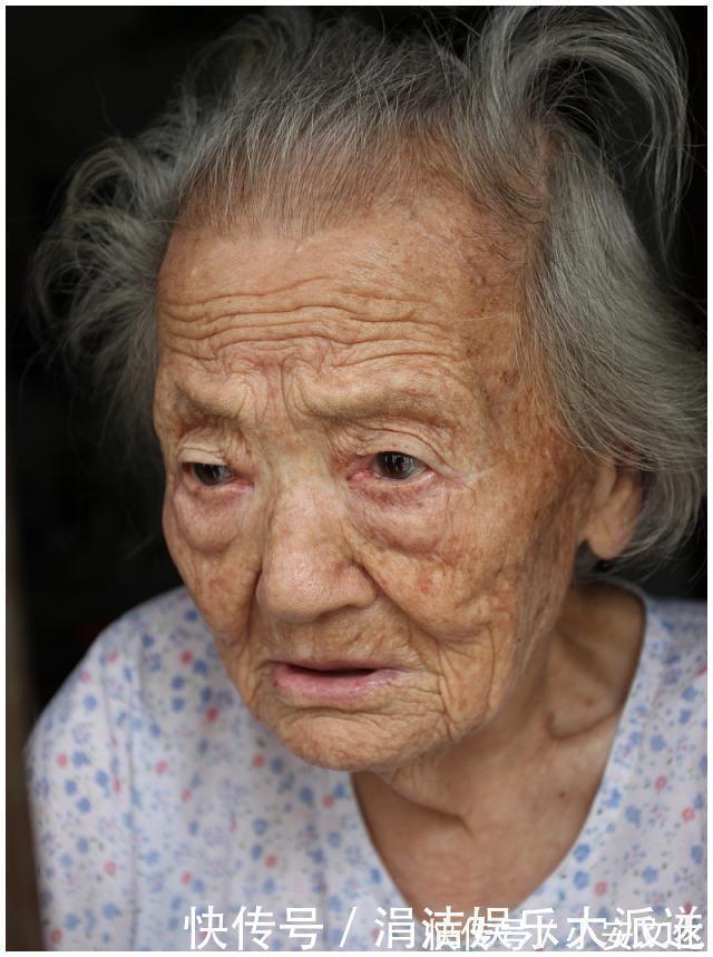 中老年人|为什么有的人老年斑“密密麻麻”，有的人却很少今天知道原因了