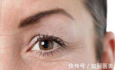 经验 做过全切双眼皮手术的"过来人",分享10条最实用的经验