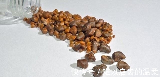 医生|切除胆囊,对身体有什么影响吗医生终于讲出大实话