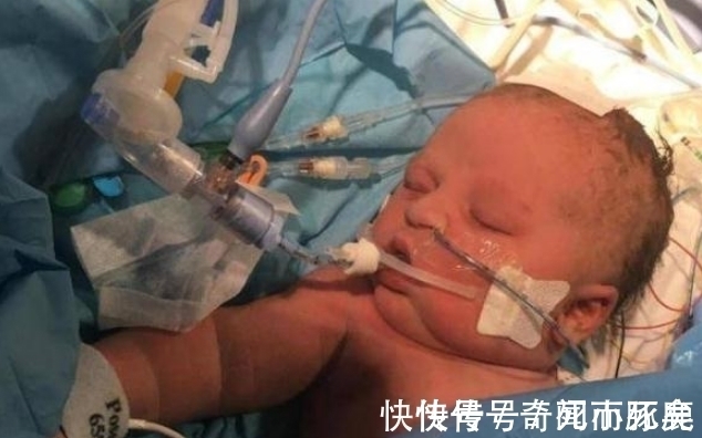 病菌|婴儿一出生就被感染病菌,在拔掉呼吸机的时候,她紧握母亲的手指