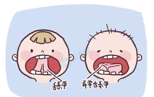 检查|孩子五岁说话不清楚,被说成是大舌头,检查时张开嘴后,医生发怒