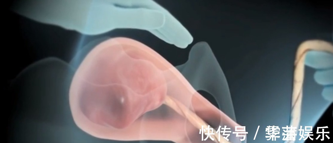 分娩|顺产到底有多疼8张图片告诉你女人顺产有多不容易