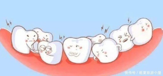 家长|为啥孩子明明不吃糖,牙齿还是特别黑这其中的原因你了解多少