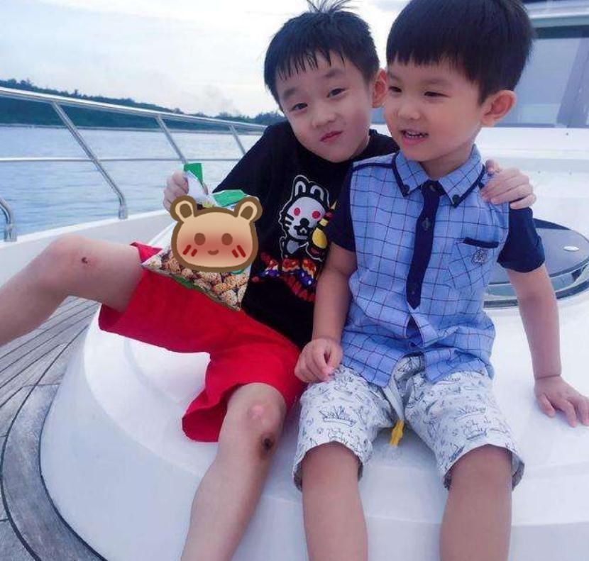 矮小症|孩子是“矮小症”还是晚长?若腿部有两个特征,身高或许能反超