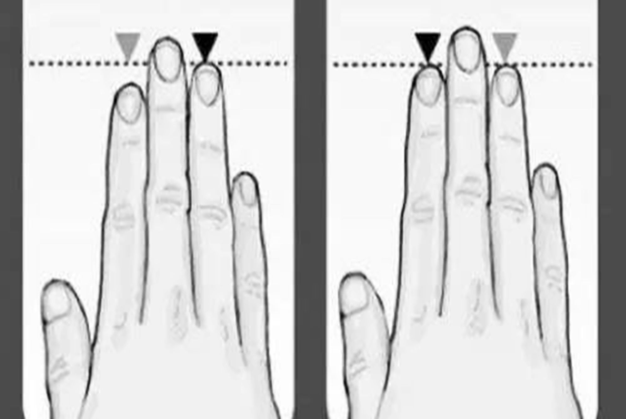 孩子|孩子食指和无名指长度差异有讲究？心理学：里面藏着三个“秘密”