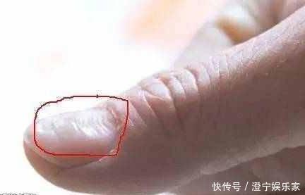 指甲长了竖纹和横纹 是身体给的什么信号 全网搜 指甲长了竖纹和横纹 是身体给的什么信号 全网搜