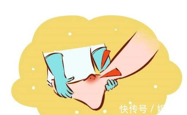 下肢浮肿|体内有癌,下半身先“发声”下半身若出现4个“信号”,别忽视