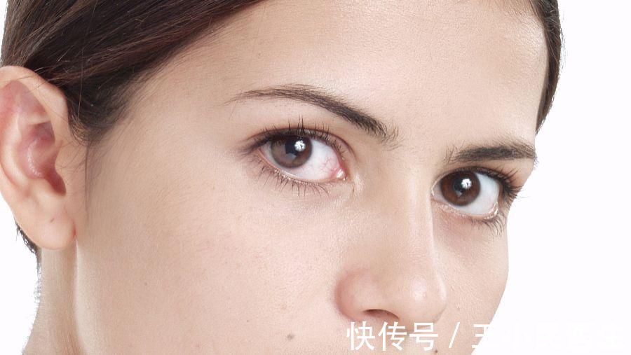 线雕 王小民教授：面部松弛需要做提升，而不是脂肪填充