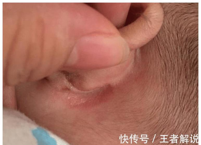 父母|6个月宝宝喜欢“抓耳朵”是暗示生病?背后诱因,新手父母要知道