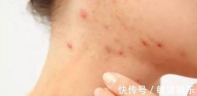 蒲公英水|高二女生,因一壶蒲公英水,被送入医院,蒲公英泡水,有4大禁忌