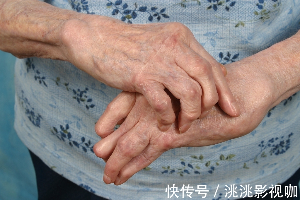 瘀血|“类风湿性关节炎”的中医治法!教你3招逼出湿气,别再被坑了!