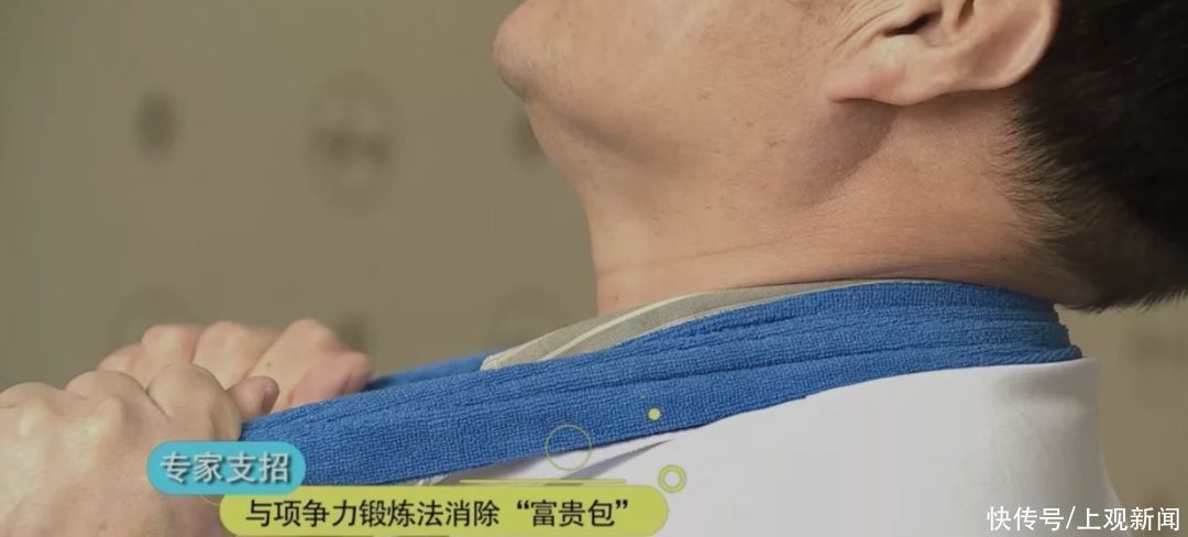 富贵包|营养过剩，缺乏锻炼？小心脖子后面长“富贵包”